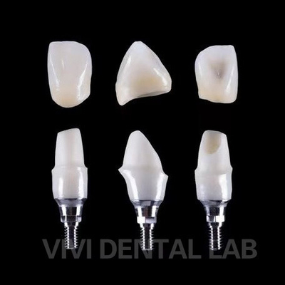 Οδοντιατρικό εμφύτευμα Tibase Zirconia Abutment Τιτάνιο ακρίβεια Προσαρμοσμένη