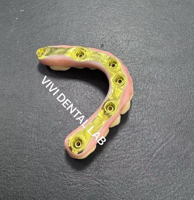 Πλήρης γέφυρα από ζιρκόνια με στήριξη από ράβδο τιτανίου