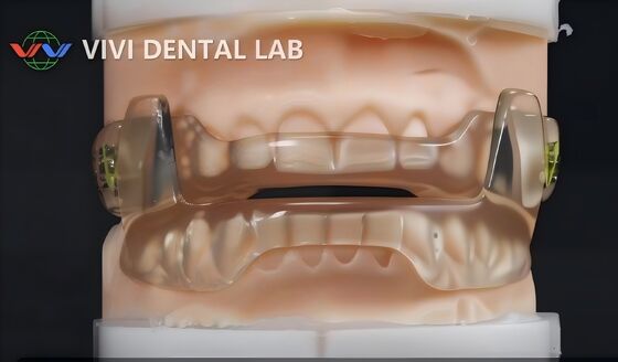ΚΙΝΑ VIVI DENTAI LABORATORY Πιστοποιήσεις