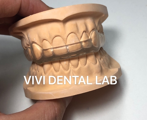 ΚΙΝΑ VIVI DENTAI LABORATORY Πιστοποιήσεις