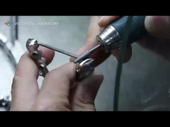 Κρόνοι και γέφυρες PFM