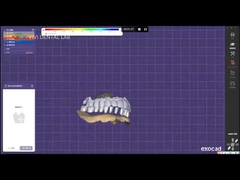 Ψηλή οδοντοστομή