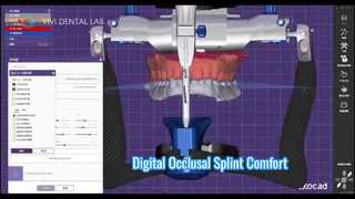 Ψηφιακός αποφρακτικός νάρθηκας Ακριβής άνεση