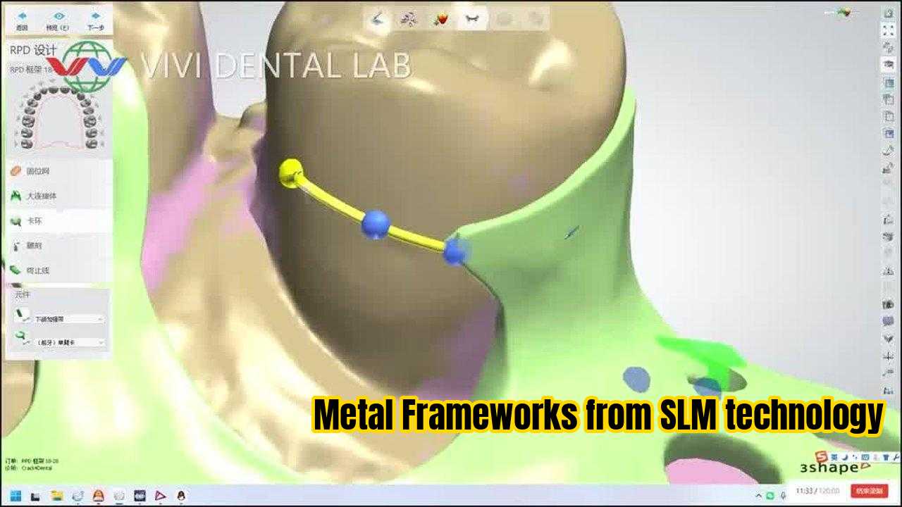 ΚΙΝΑ VIVI DENTAI LABORATORY Πιστοποιήσεις